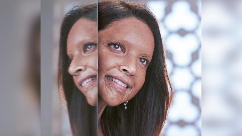 SEE THE FIRST LOOK OF DEEPIKA PADUKONE AS ACID ATTACK SURVIVOR